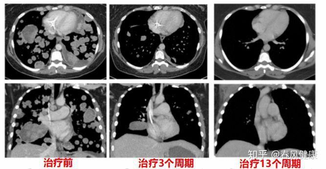 间歇性厌友症的深度解析与应对之道