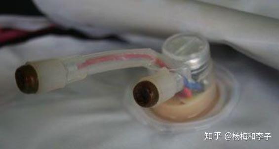 如何选购安全的暖宝宝，品牌与温控技术的重要性