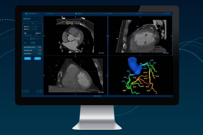 先进医疗影像平台，提升诊断效率与精准度